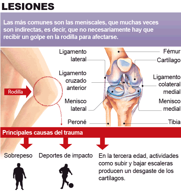 Traumas de rodilla, Salud, La Revista
