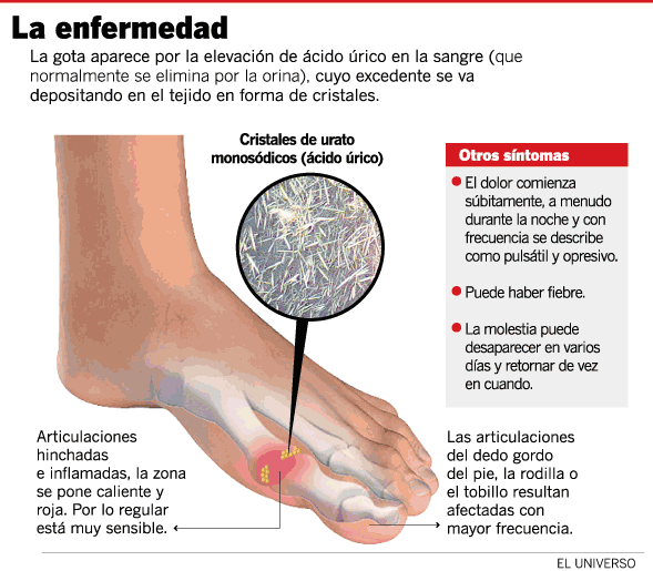 La desaparición de los asteriscos vasculares los métodos